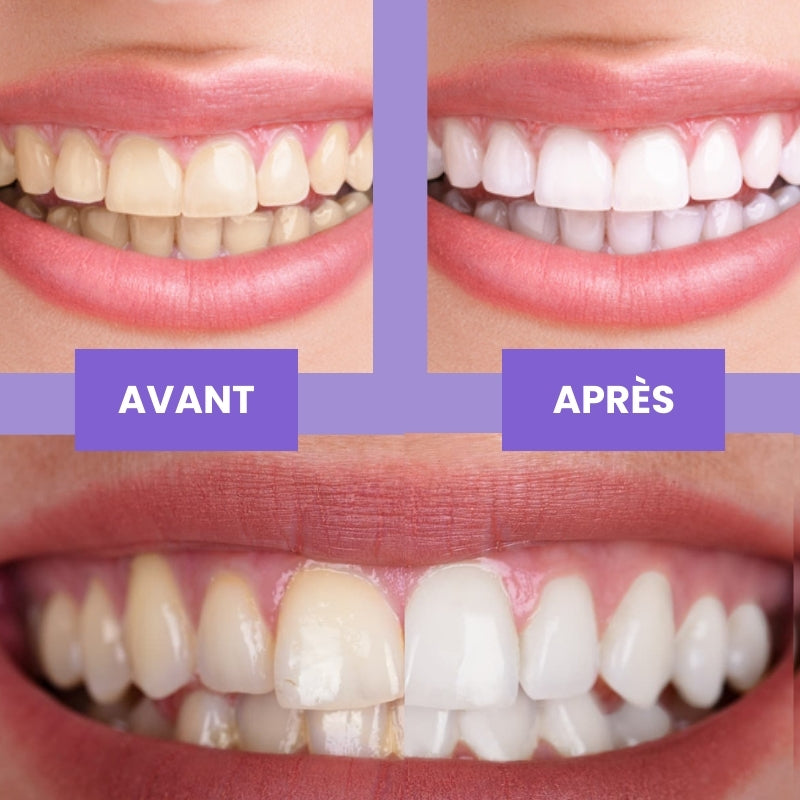 Sérum Correcteur de couleur V34 - White Smile